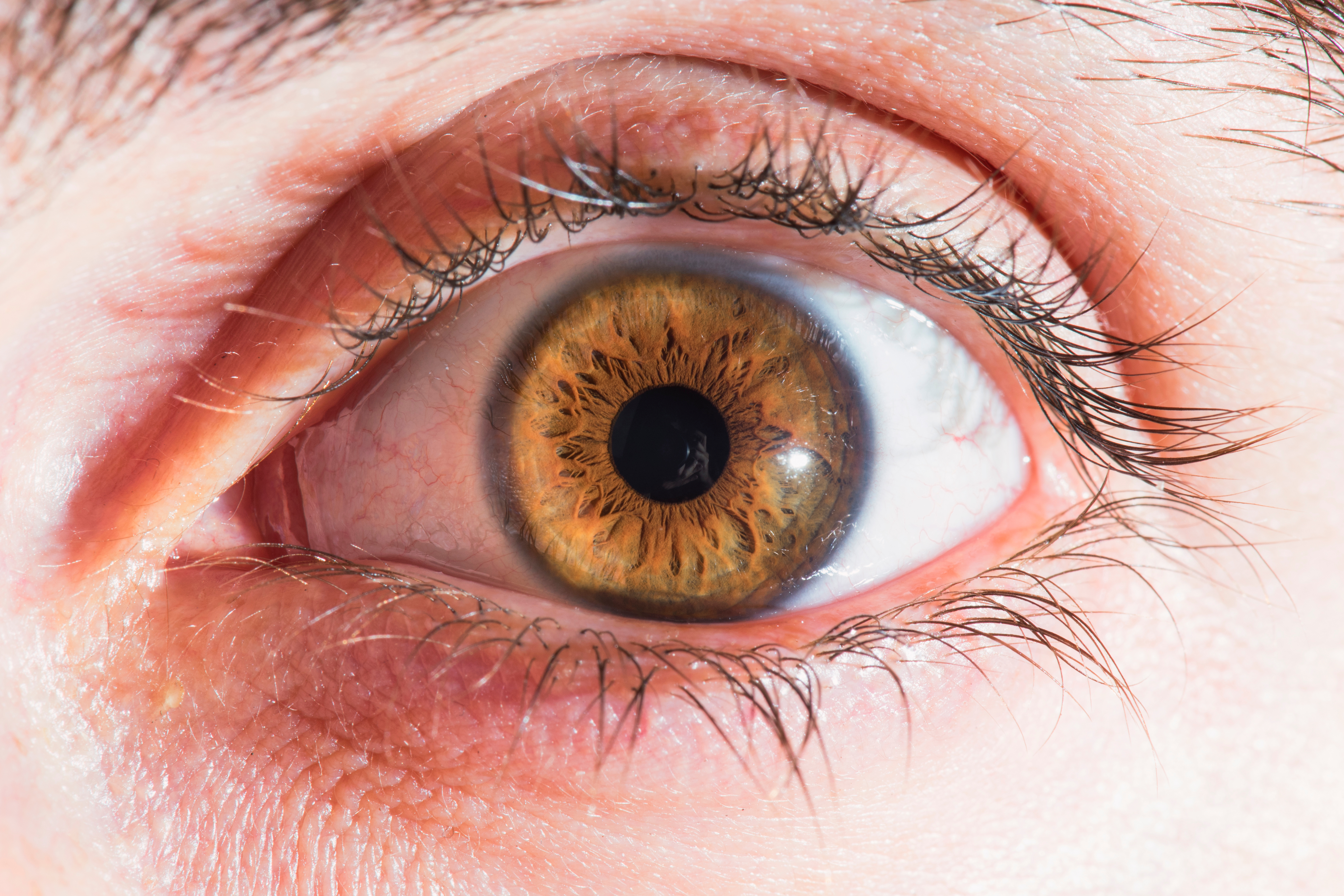 Image for Bengali -Your guide to diabetic retinopathy