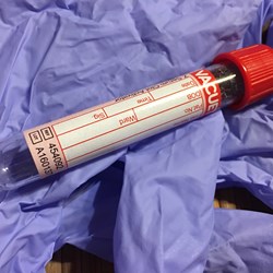 Image for HbA1c and Time in Range Explained