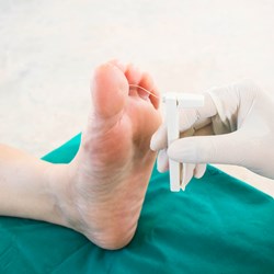 Image for Somerset Foot Service - High Risk of Developing a Foot Ulcer